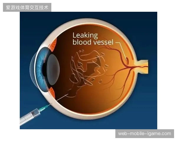 奥体中心高密度人群覆盖下如何借5G切片实现毫米级直播同步